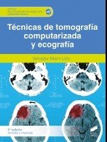 TECNICAS DE TOMOGRAFIA COMPUTERIZADA Y ECOGRAFIA 2ª ED - 9788413572154