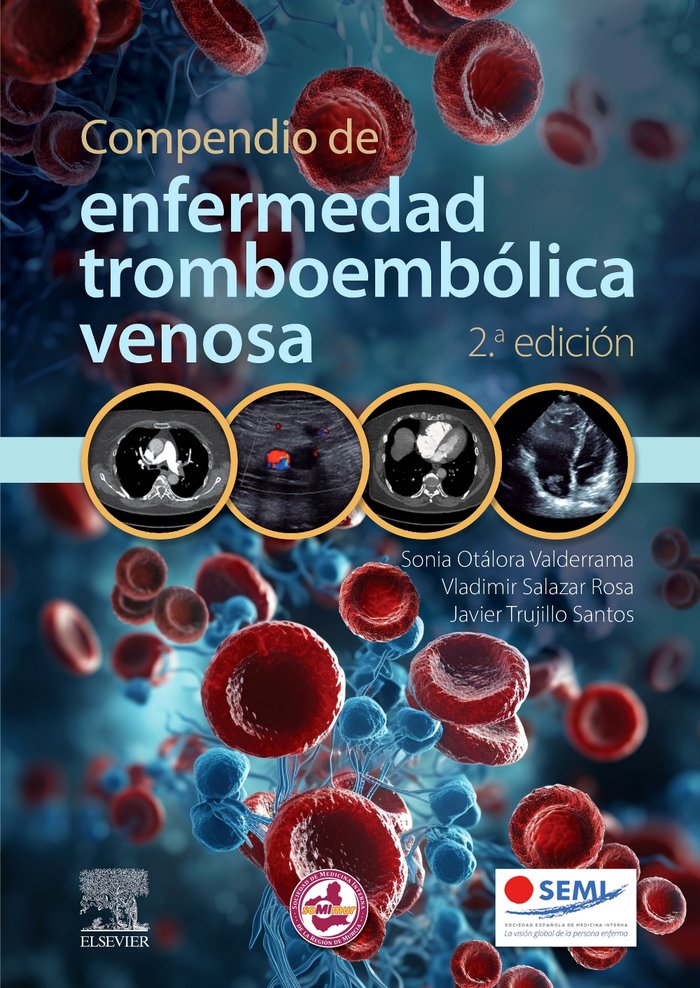 COMPENDIO DE ENFERMEDAD TROMBOEMBOLICA VENOSA 2ª ED - 9788413824277