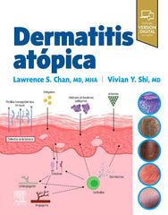 DERMATITIS ATOPICA - 9788413824413