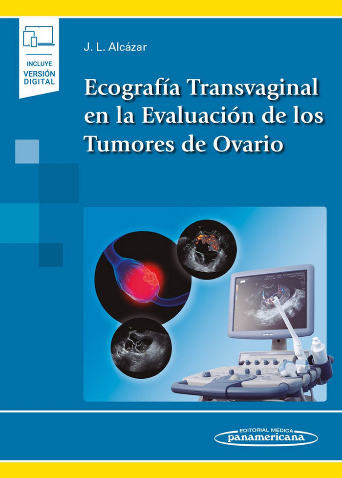 ECOGRAFIA TRANSVAGINAL EN LA EVALUACION DE LOS TUMORES DE OV - 9788491104971