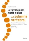 DEFORMACIONES MORFOLOGICAS DE LA COLUMNA VERTEBRAL - 9788491130635