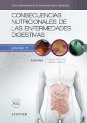 CONSECUENCIAS NUTRICIONALES DE LAS ENFERMEDADES DIGESTIVAS - 9788491131687