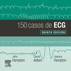 150 CASOS DE ECG - 9788491135043