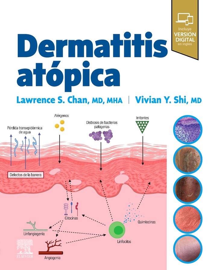DERMATITIS ATOPICA - 9788413824413 Imagen principal del producto