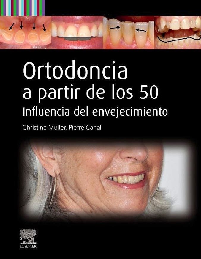ORTODONCIA A PARTIR DE LOS 50 - 9788413828077