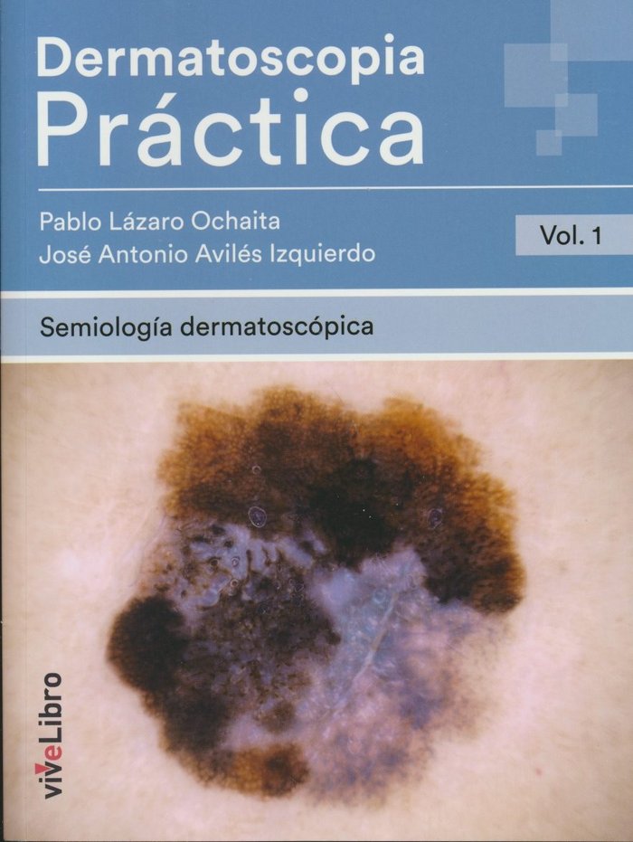 DERMATOSCOPIA PRACTICA VOL 1 SEMIOLOGIA DERMATOSCOPICA - 9788417089399 Imagen principal del producto