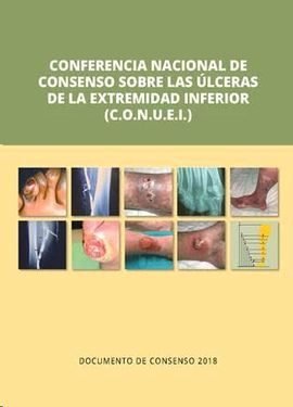 CONFERENCIA NACIONAL CONSENSO SOBRE ULCERAS DE LA EX - 9788417194260