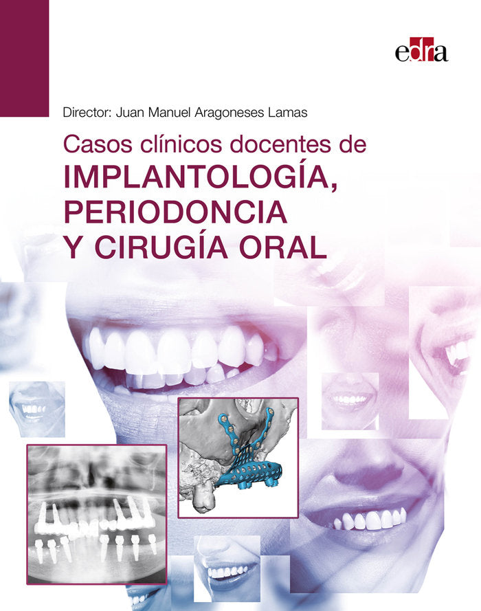 CASOS CLINICOS DOCENTES DE IMPLANTOLOGIA PERIODONCIA Y CIRU - 9788418706554