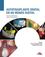 AUTOTRASPLANTE DENTAL EN UN MUNDO DIGITAL - 9788419156044 Imagen principal del producto