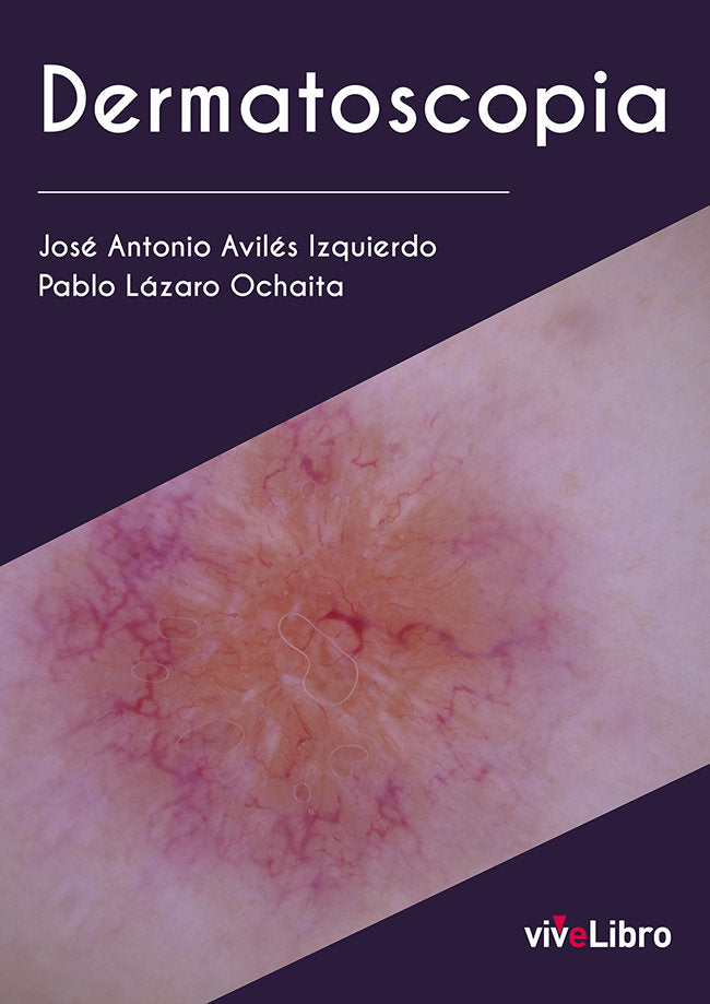 DERMATOSCOPIA - 9788419489128 Imagen principal del producto
