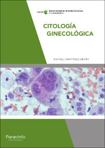 CITOLOGIA GINECOLOGICA GS 17 - 9788428338059 Imagen principal del producto