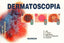 DERMATOSCOPIA PAUTAS DE DIAGNOSTICO - 9788471015198