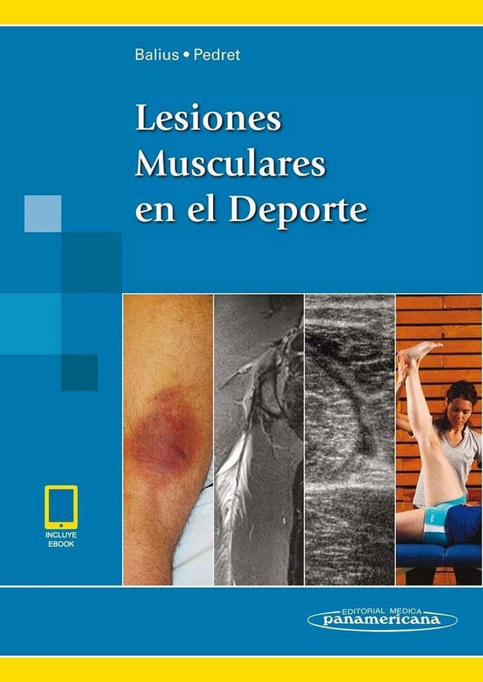 LESIONES MUSCULARES EN EL DEPORTE INCLUYE EBOOK - 9788491104797 Imagen principal del producto