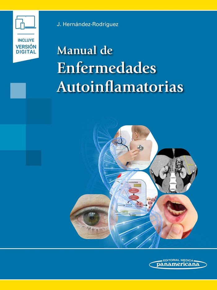 MANUAL DE ENFERMEDADES AUTOINFLAMATORIAS - 9788491109143 Imagen principal del producto