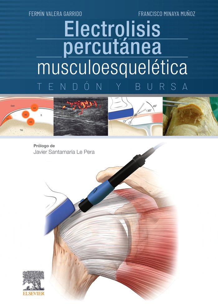 ELECTROLISIS PERCUTANEA MUSCULOESQUELETICA TENDON Y BURSA - 9788491130161 Imagen principal del producto