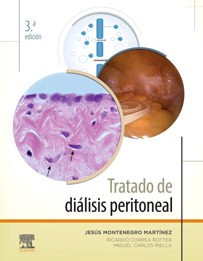 TRATADO DE DIALISIS PERITONEAL 3ª ED - 9788491134718