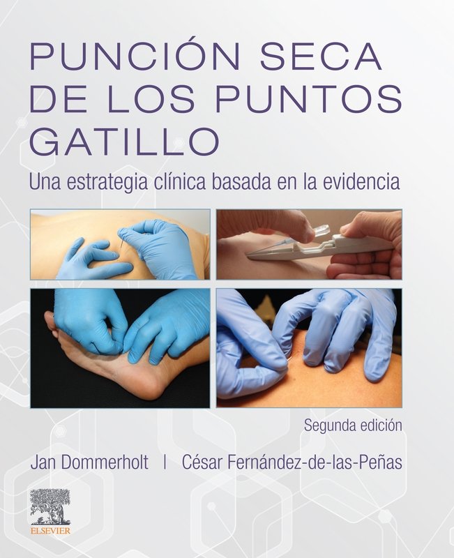 PUNCION SECA DE LOS PUNTOS GATILLO 2ªED - 9788491134930
