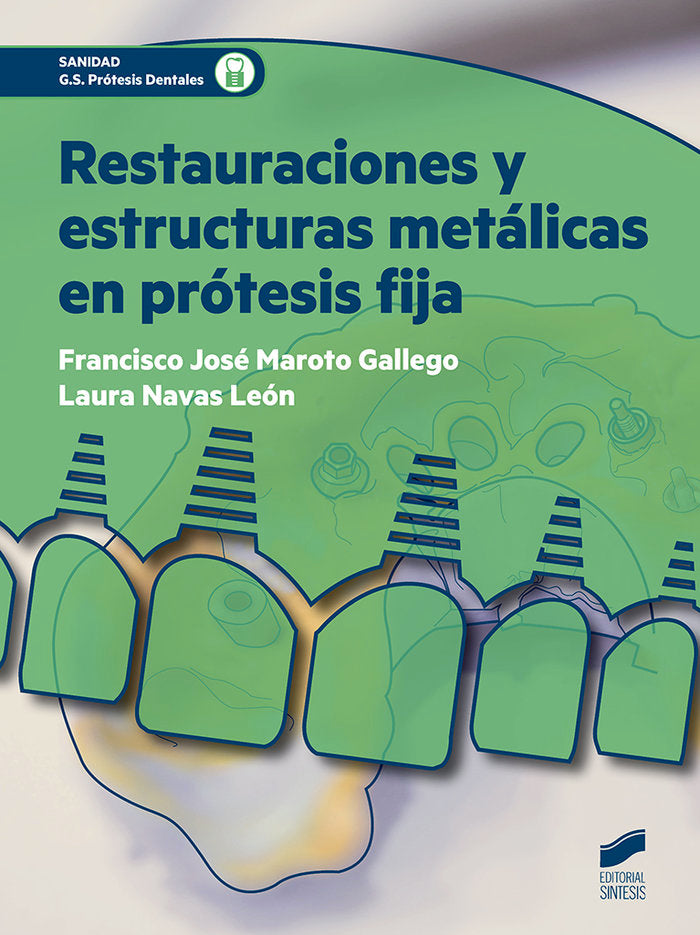 RESTAURACIONES Y ESTRUCTURAS METALICAS EN PROTESIS FIJA - 9788491710172 Imagen principal del producto